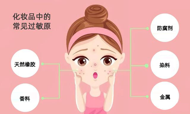 常见过敏原